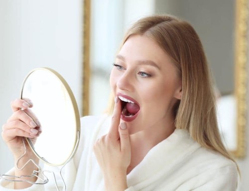 Why Smile Makeovers Fail — And How Experts Fix Them